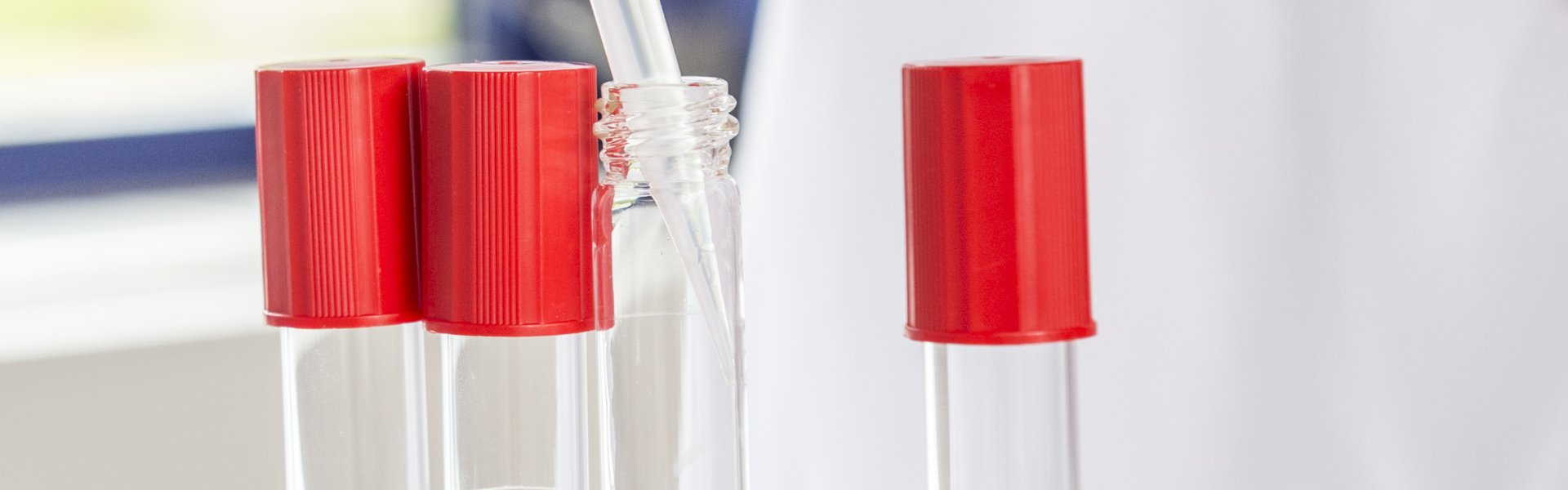 Further service solutions of the DIOSNA experts at a glance